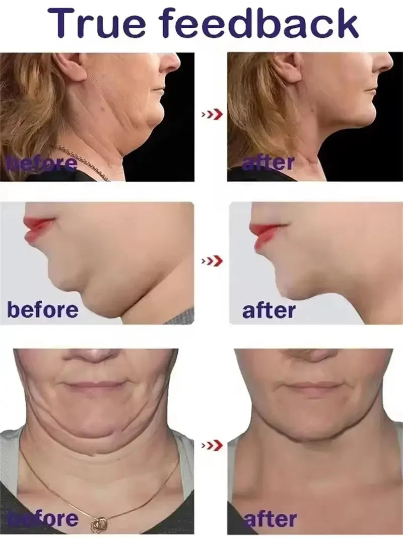 V-Shape Firming Face-lift Slimming Mask Removal Masseter Muscle Double Chin Face Fat Burning Anti-aging Beauty Products New